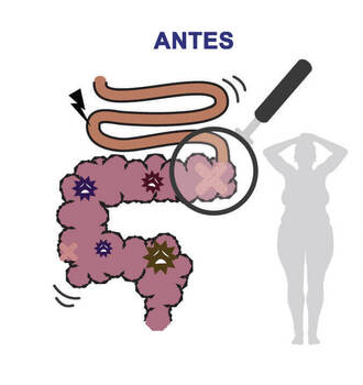 Los intestinos están llenos de depósitos, incapaces de quemar grasa. Mal metabolismo. Limpia los intestinos con una motilidad saludable. Metabolismo saludable y quema de grasa rápida.